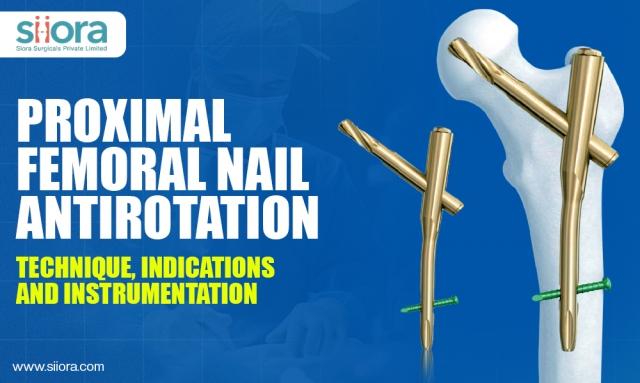 Proximal Femoral Nail Antirotation (PFNA): Technique, Indications & Instrumentation